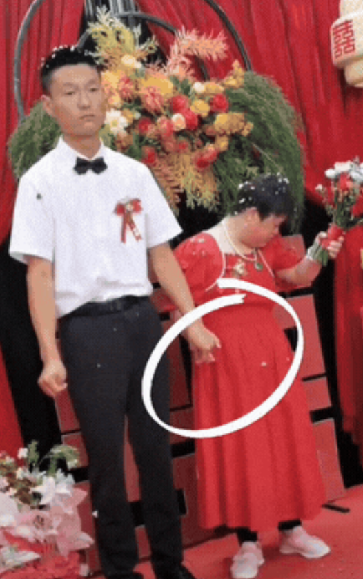 “看着心疼啊！”近日，河南一小帅伙终于结婚了，网友都觉得不可思议！小伙看起来很不