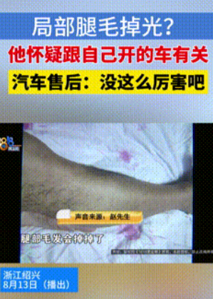 这下解释不清了！”浙江诸暨，男子驾驶新能源车1年后，忽然看到自己两条腿上本来茂密
