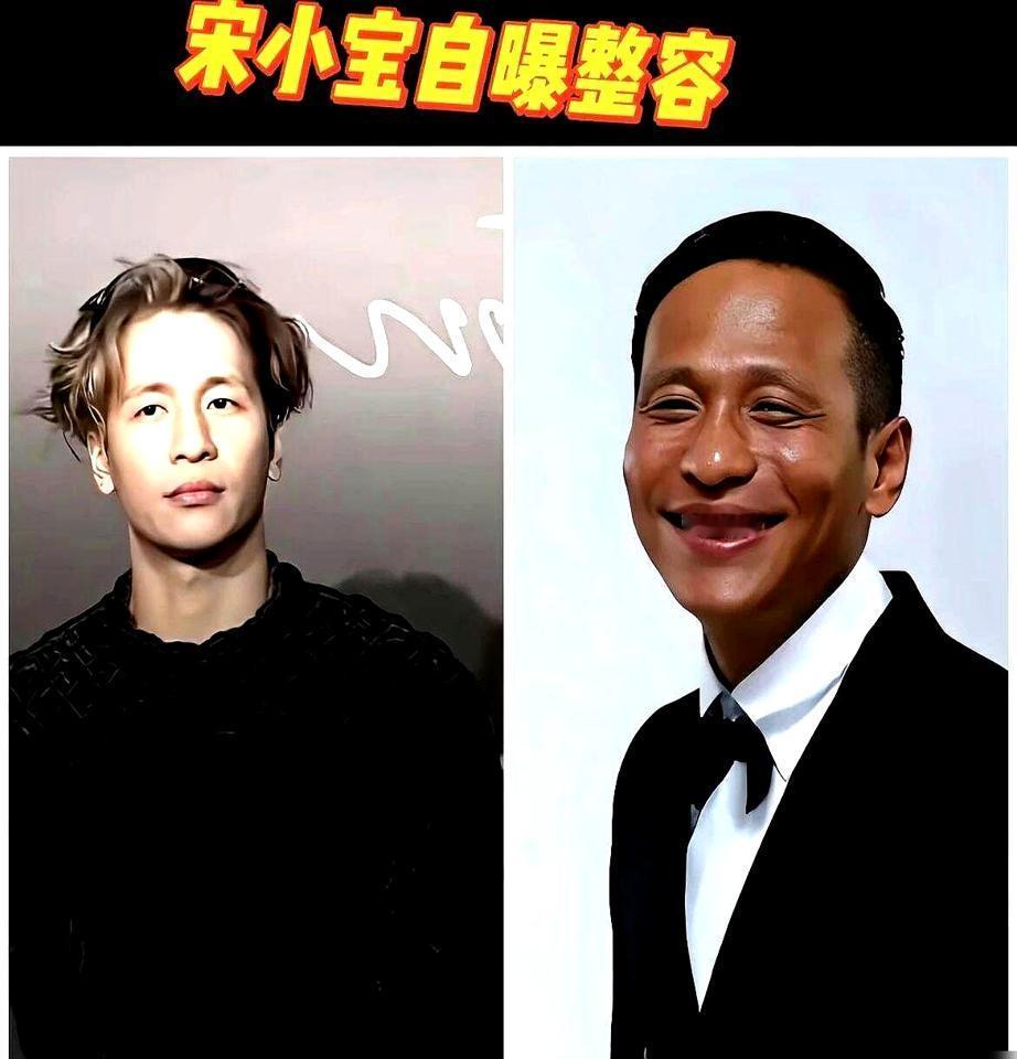 “他花了几万，眉毛多了600根”，宋小宝的“植眉”经历，沈腾贾玲笑趴，可背后真相