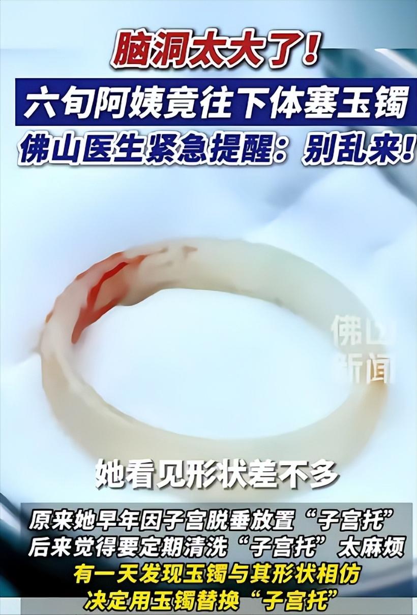 广东，一65岁阿姨因为“阴道异物”去医院检查，结果医生发现里面竟有一只玉镯，几经