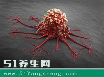 警惕! 一家人因为长期吃它, 都患癌住院了, 很多人经常这样吃!