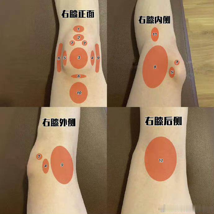 【科普预告】中午12点半，来给大家盘点“膝盖疼痛”，可以先看这张总结图，你的膝盖