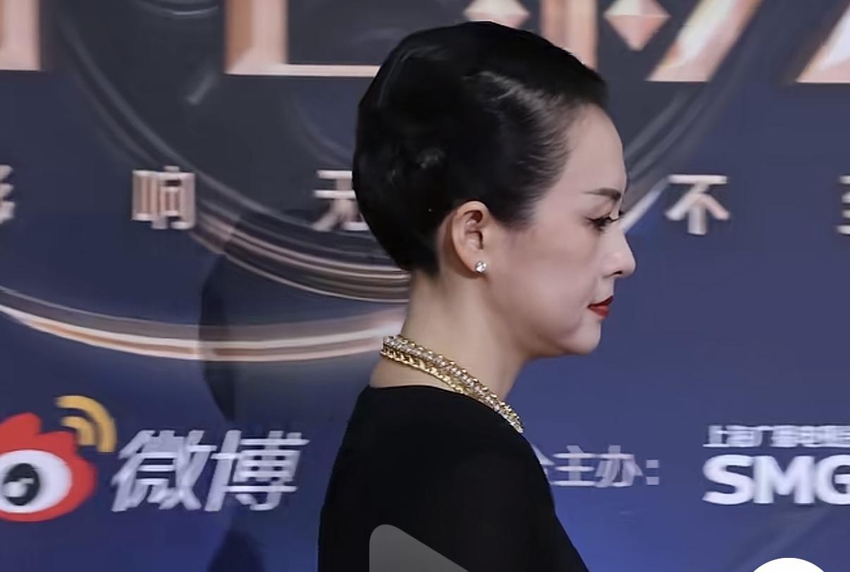 图一，是1年前的章子怡图二、是现在的章子怡一年前的章子怡脸就已经变了，看侧脸