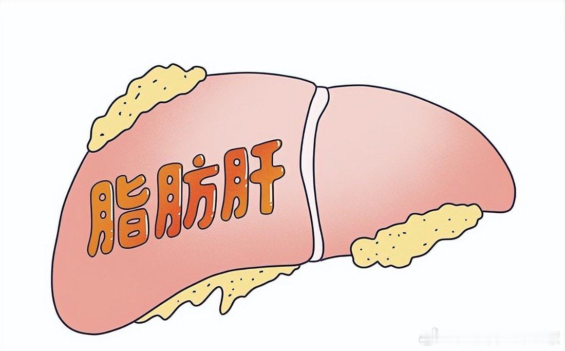 脂肪肝是要少吃主食还是少吃肉健闻登顶计划很多查出脂肪肝的朋友会纠结：是该戒掉米