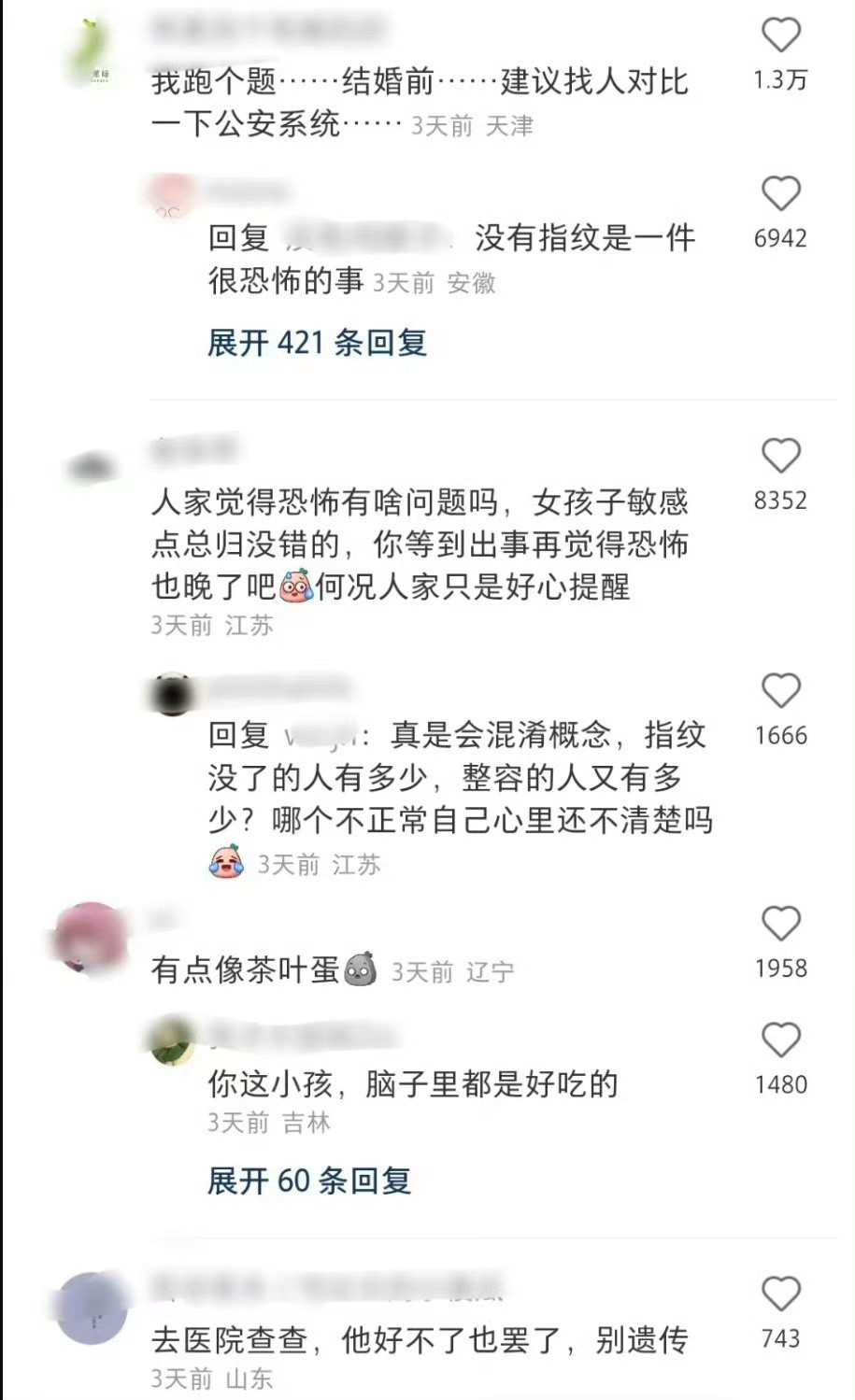 这个手好像真的看不到指纹​​​