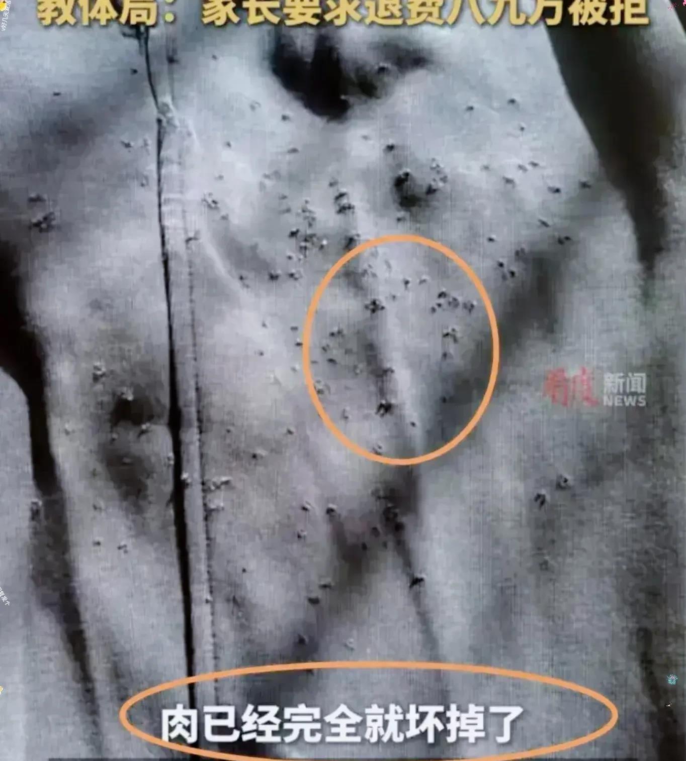 震惊！济南六年级女生遭同桌狂扎218针！校方竟称