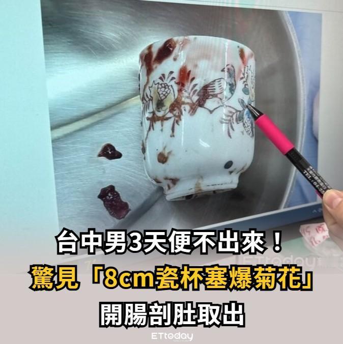 对岸奇葩天天有！台媒：台湾省中部一名男子腹胀三天无法大便，肚子痛到受不了，赶紧