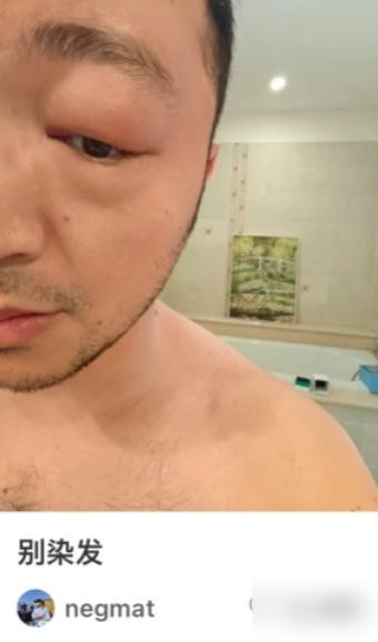 尼格买提那只肿眼，根本不是提醒你别染发。我告诉你，这是教科书级的流量密码。他