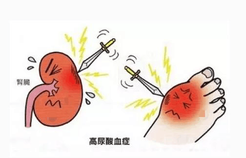 医生告诫: 一旦尿酸高, 这三类东西可千万别再吃了!