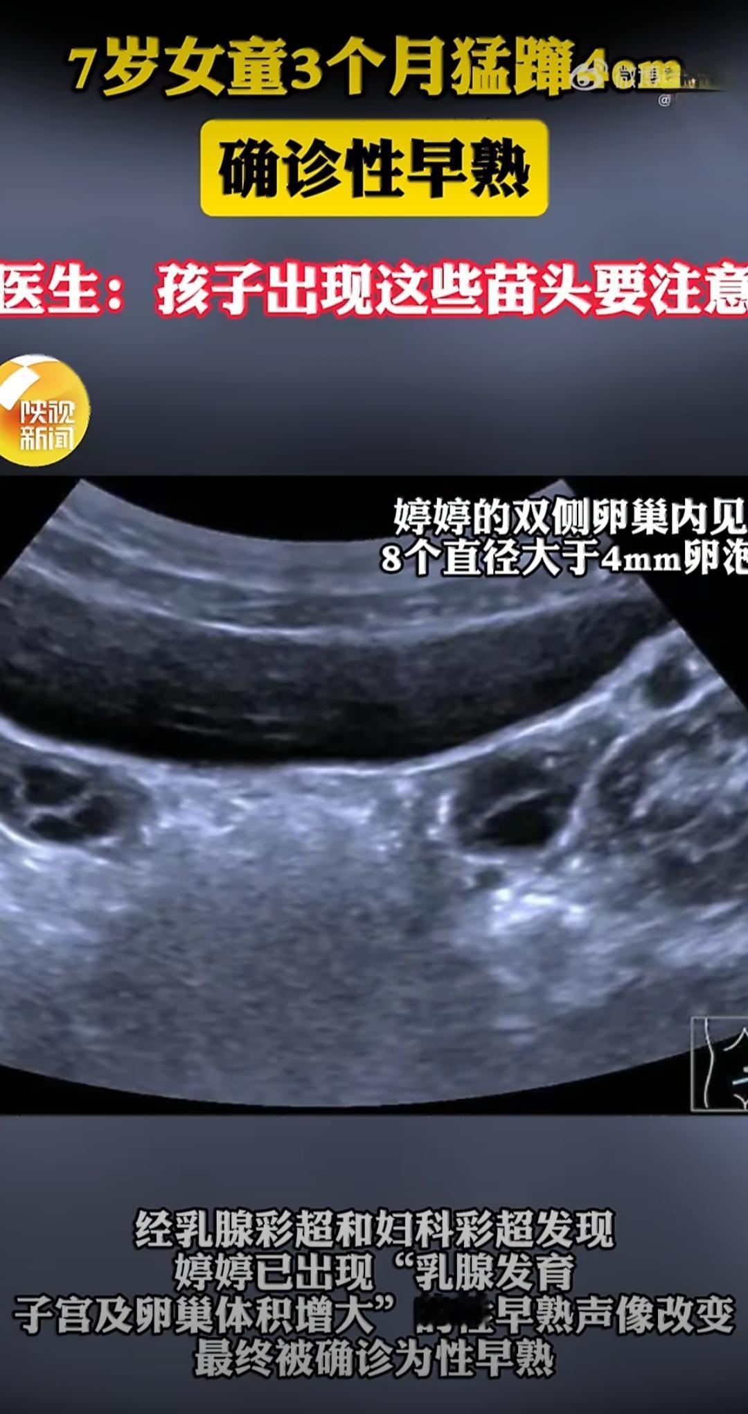 福建7岁女童婷婷短短3个月身高猛蹿4厘米，家长一开始满心欢喜，觉得孩子长得快是好