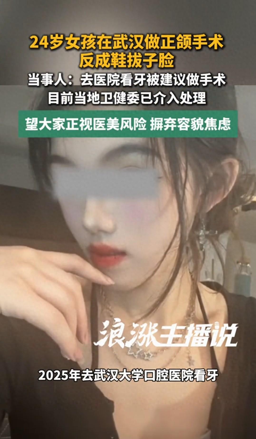 正颌手术被整成鞋拔脸！碰上这样的医生，算是倒霉透顶了！24岁女孩小美，大眼睛