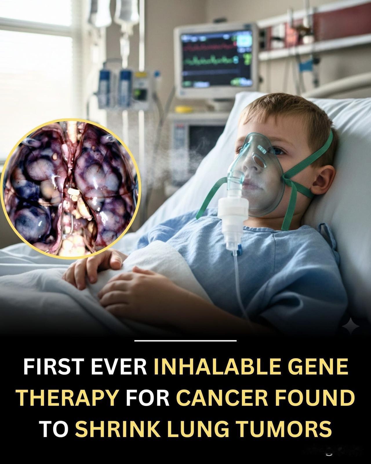 突破：美国科学家可能找到了一种通过呼吸缩小肺部肿瘤的方法！科学家们研发出首个