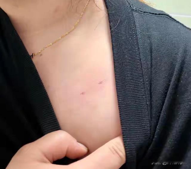 云南昭通，一女子一个人在家，正准备洗澡，结果突然听见外头有脚步声，还没反应过来，