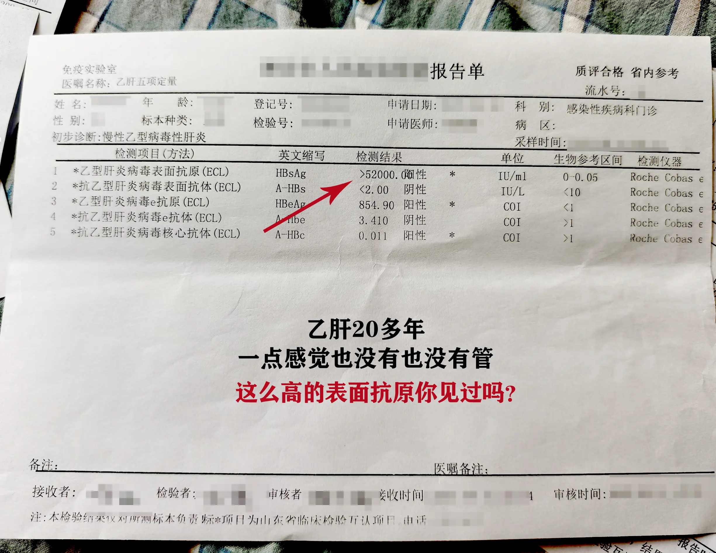 你这样的乙肝五项我见的太多了，表面抗原只是乙肝的外壳蛋白，抗原高代表病...
