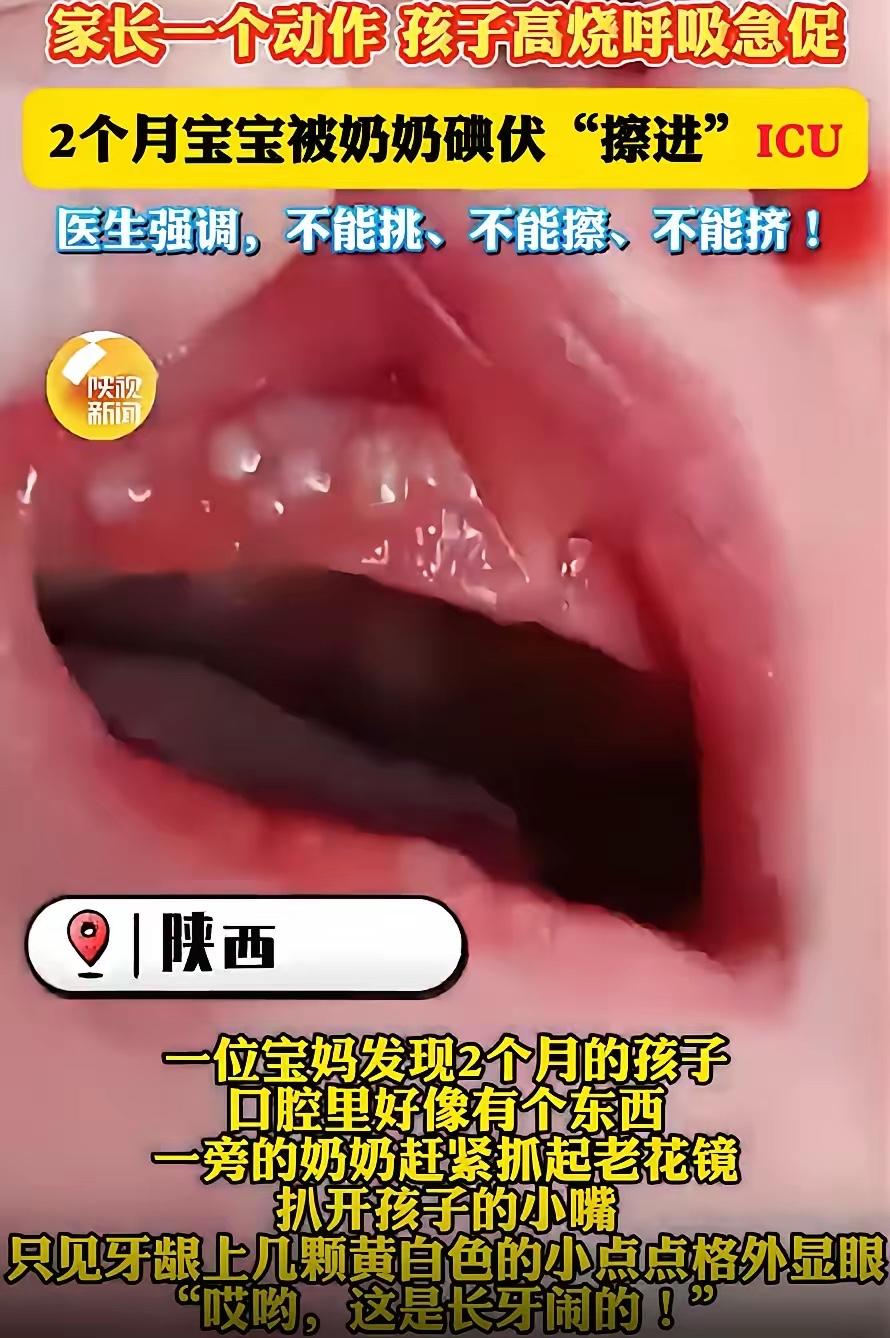 陕西西安，一位宝妈在家里带2个月的孩子，偶然发现孩子的嘴里好像有个东西，就询问经
