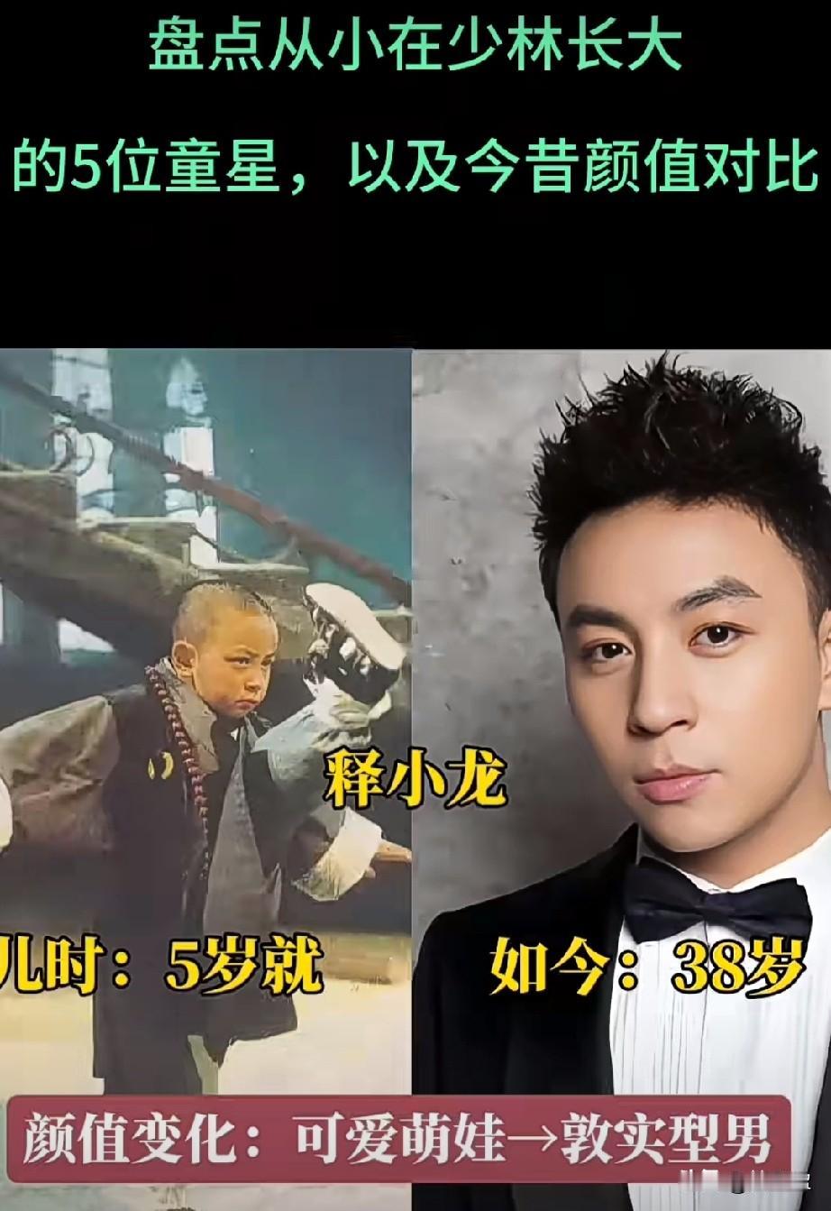 盘点从现在少林寺长大的5位童星以及今昔颜值对比，你更喜欢哪一位？