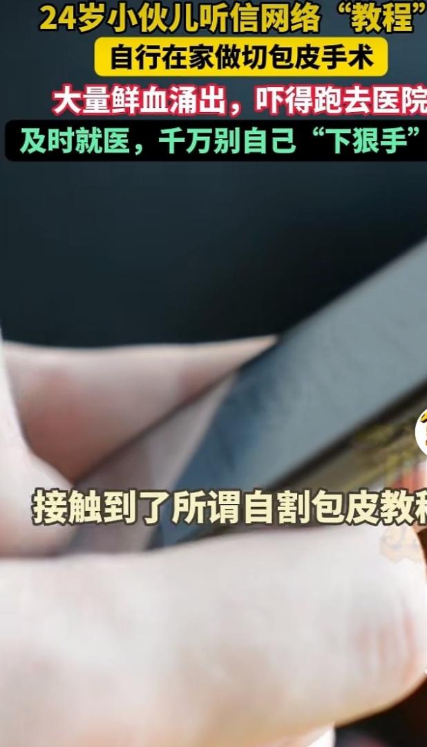 胆子太大！上海24岁小伙，觉得自己的包皮太长，于是便自己在网络上搜索“教程”学怎
