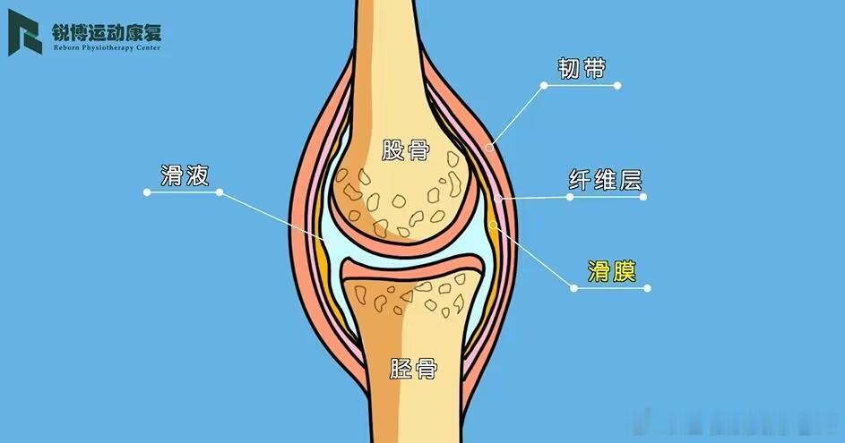 膝盖疼痛【滑膜炎】膝盖疼，检查显示滑膜炎，究竟什么是滑膜炎，又该如何康复处理呢