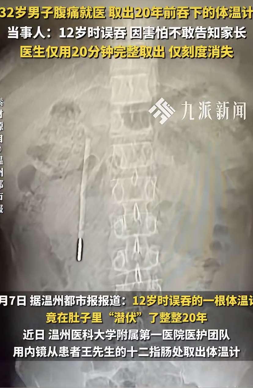 32岁的王先生最近肚子总不舒服，去温医大附一院龙港院区做了个腹部CT。结果把医生