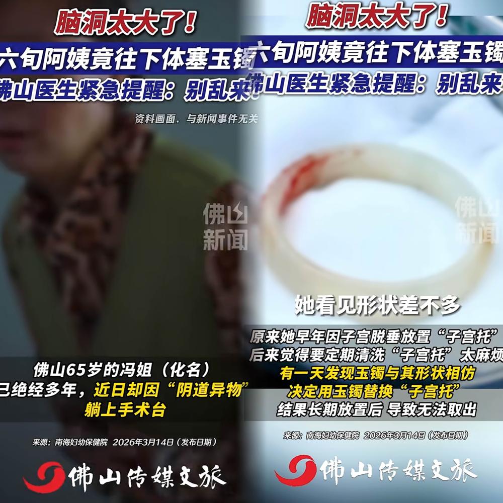 她把祖传玉镯塞进身体用了好几年，取出来时镯子都裂了。医生都后怕，说再晚点，碎