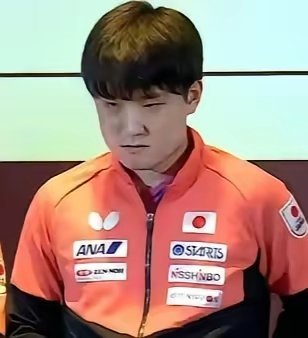 成都让张本智和记仇了。张本智和:我在比赛中的遭遇，我记着了。张本美和:面对中国选