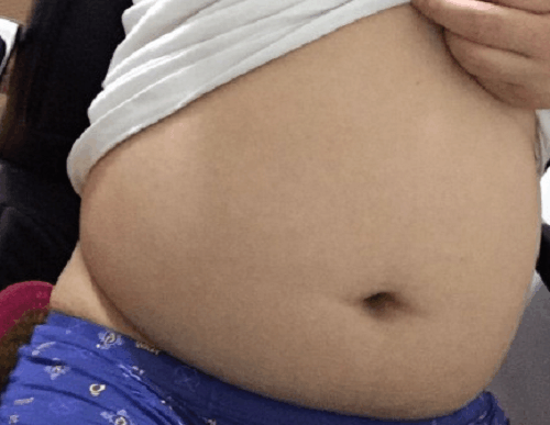 怕3岁孙女缺失母爱奶奶做出决定, 致宝宝满身伤痕, 奶奶心生愧疚