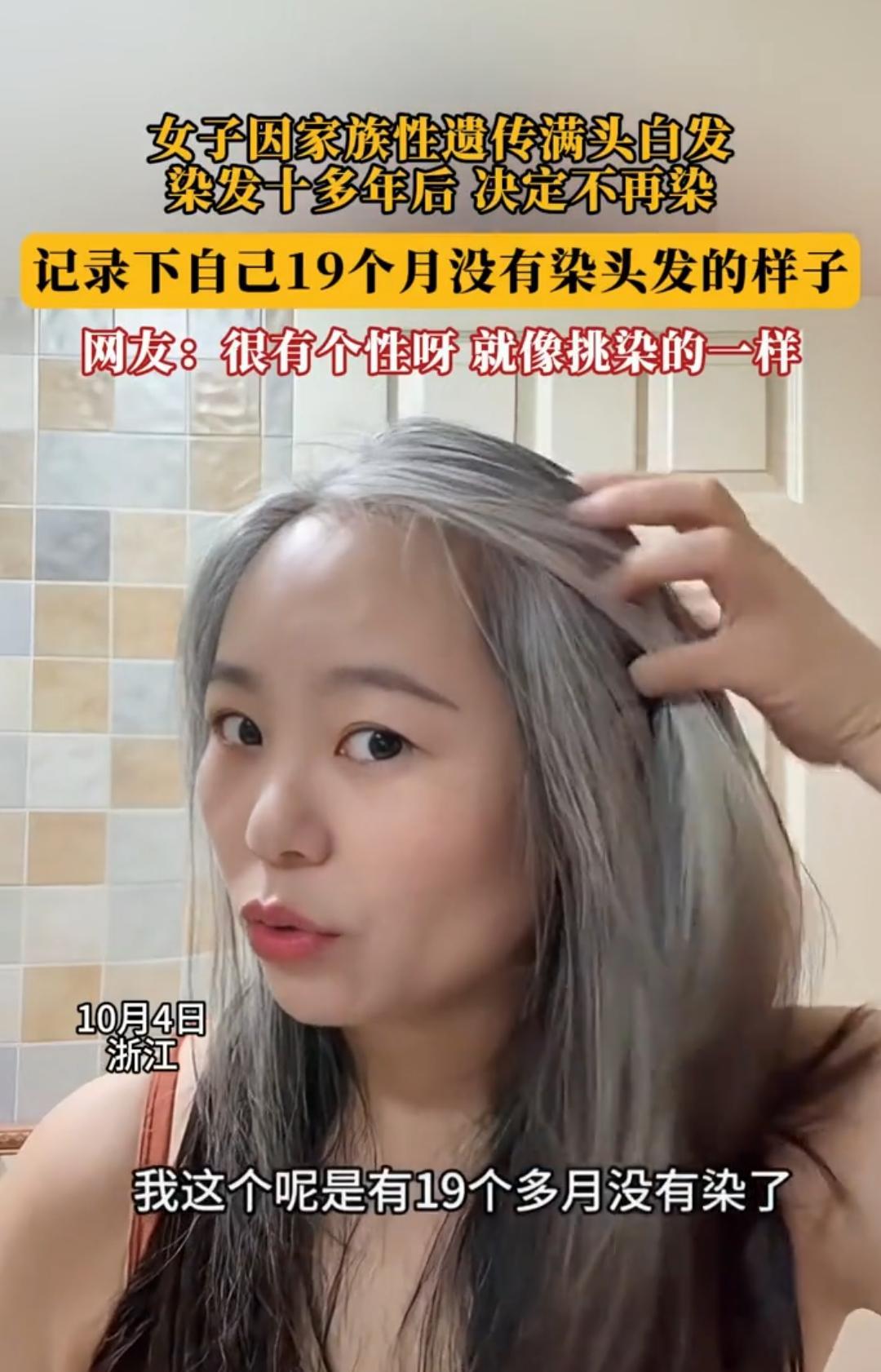 浙江，一女子因家族性遗传，满头都是白发，以前她担心白发不好看，一直染头发，染了1