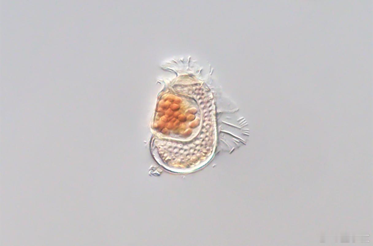 科学家发现病毒细菌中间体科学家发现远古寄生菌最近，科学家意外发现了一种前所未见的