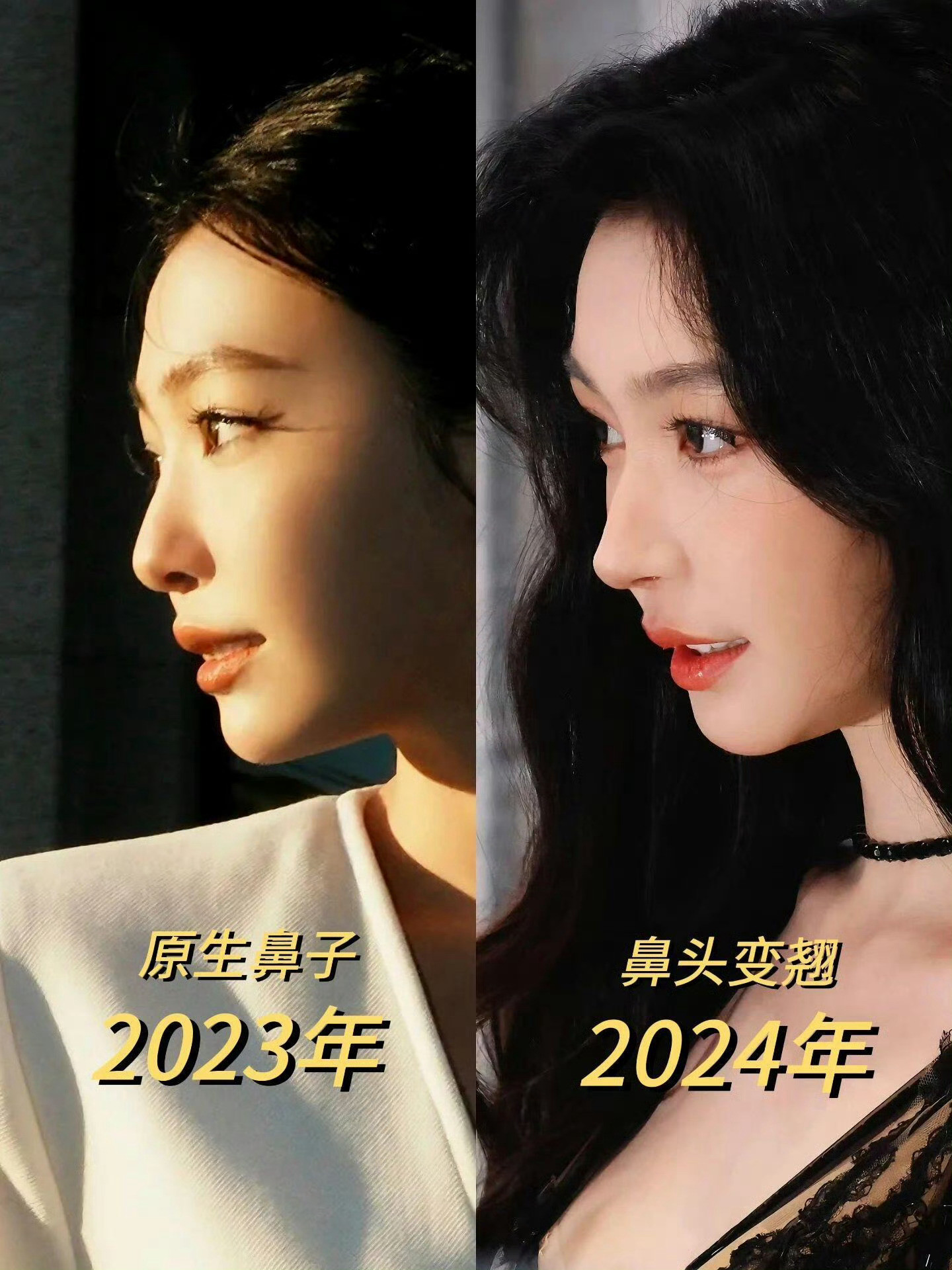 一个鼻子，让易梦玲从网红彻底有了星味，颜值升级也是肉眼可见。