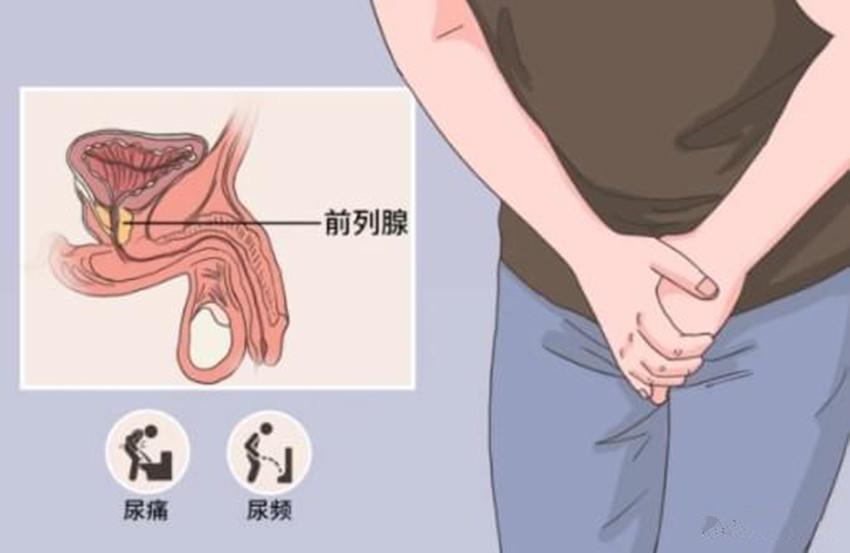 前列腺增大有哪些影响？有什么害处？前列腺增大的问题应该说很多男性并不会感到陌