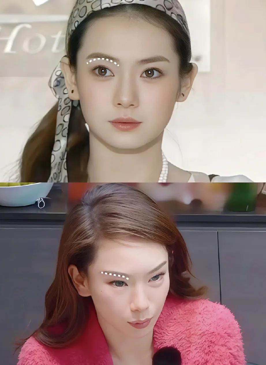 戚薇的现状给所有女人提了个醒，戚薇综艺掀了刘海，脸肿得厉害。以前灵动的眼睛