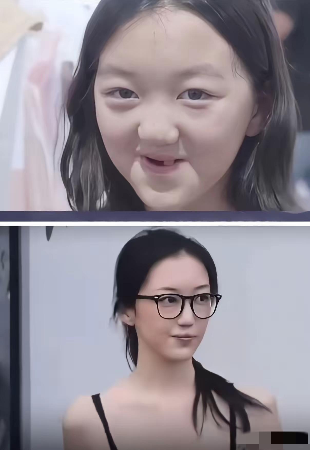 她是拿钱夯的。自己也遭罪了，而且是反复遭罪。前后做了好多次手术，因为她，多少特殊
