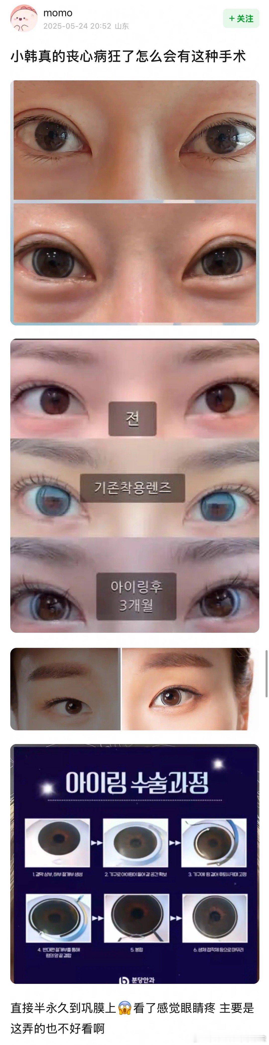 纹美瞳吗？​​​
