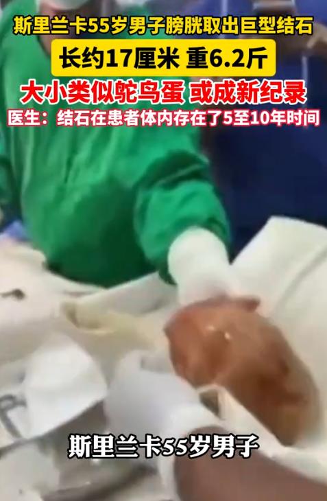 太离谱了！8月19日报道，斯里兰卡，一名55岁的患者因中风入院，治疗时才发现排尿