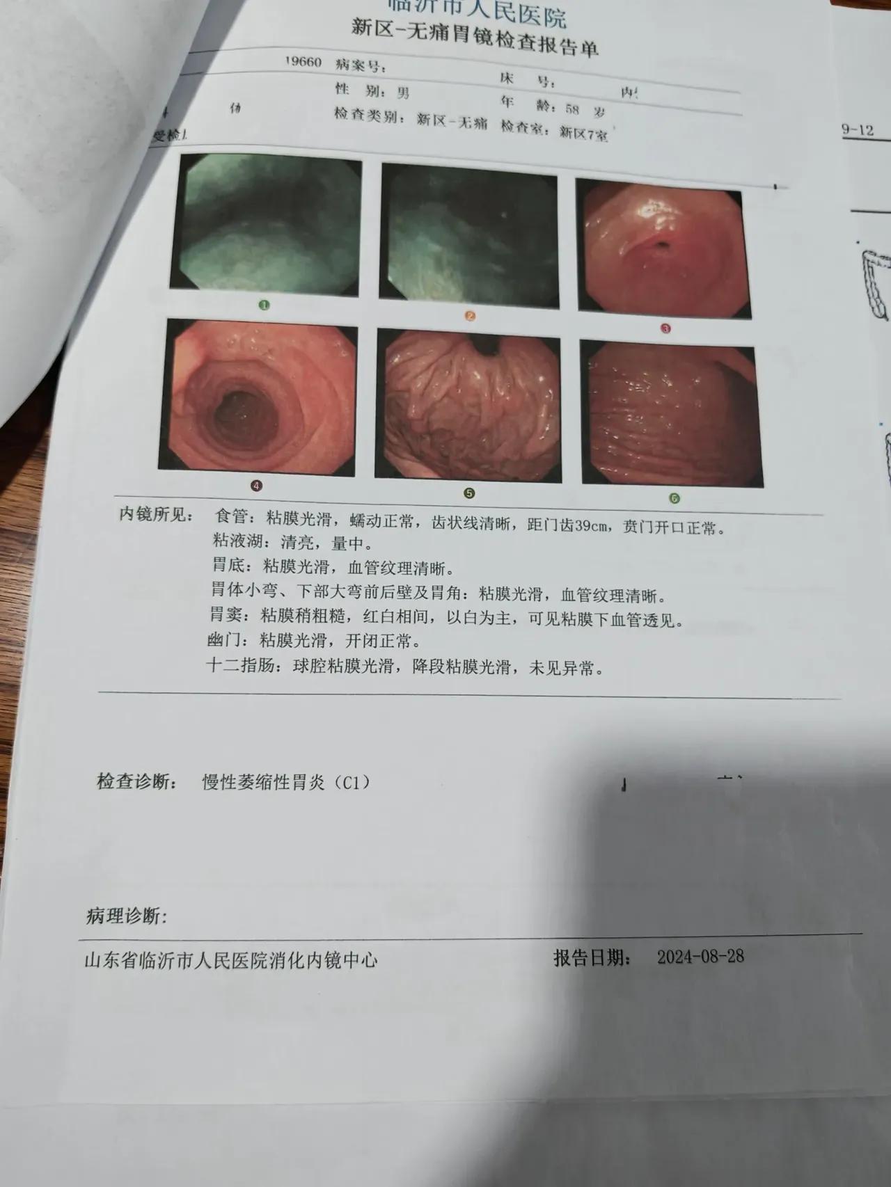 要说修复胃黏膜的“冠军”啊，从咱们中医养生来看，还真不是某一种神奇的食物，而是一