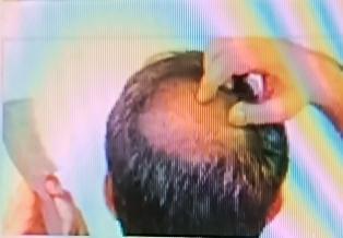 掉头发原因可不少。中医讲，精血不足头发就没法好好生长，就像地里没肥料庄稼长不好；