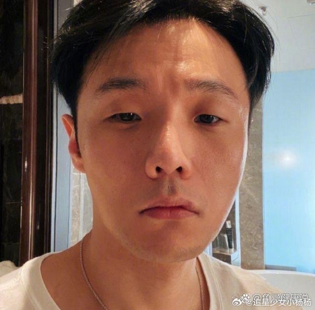 李荣浩割了双眼皮，颜值立马提升，可却没了以往那种让人一眼就能认出的独特辨识度啦