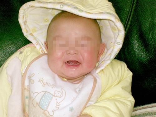 2个月宝宝湿疹化脓, 婆婆说是快好了, 娘家人送医后骂婆婆老糊涂
