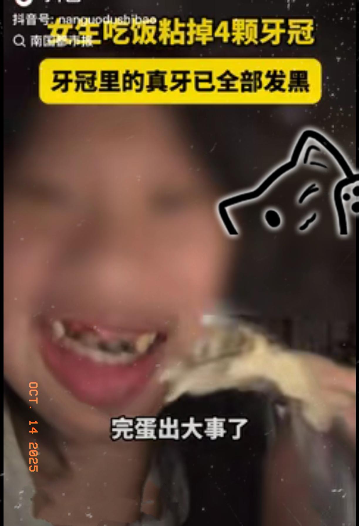 “这下悲剧了！”据南国都市报9月29日报道，福建一女生吃饭时，突然感觉门牙一阵清