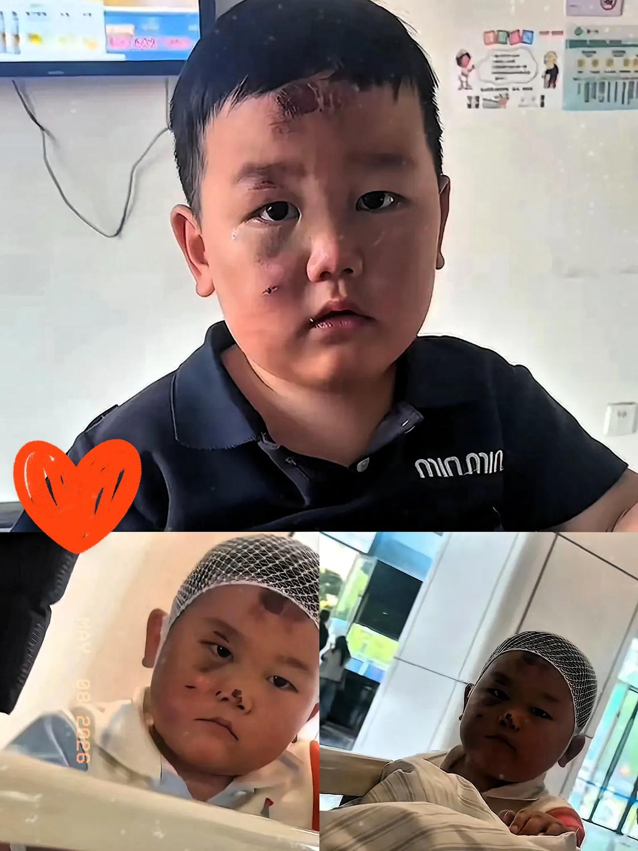 全网心疼的鼻青脸肿护母小男孩，妈妈身份终于官宣，背后真相看得所有人瞬间破防