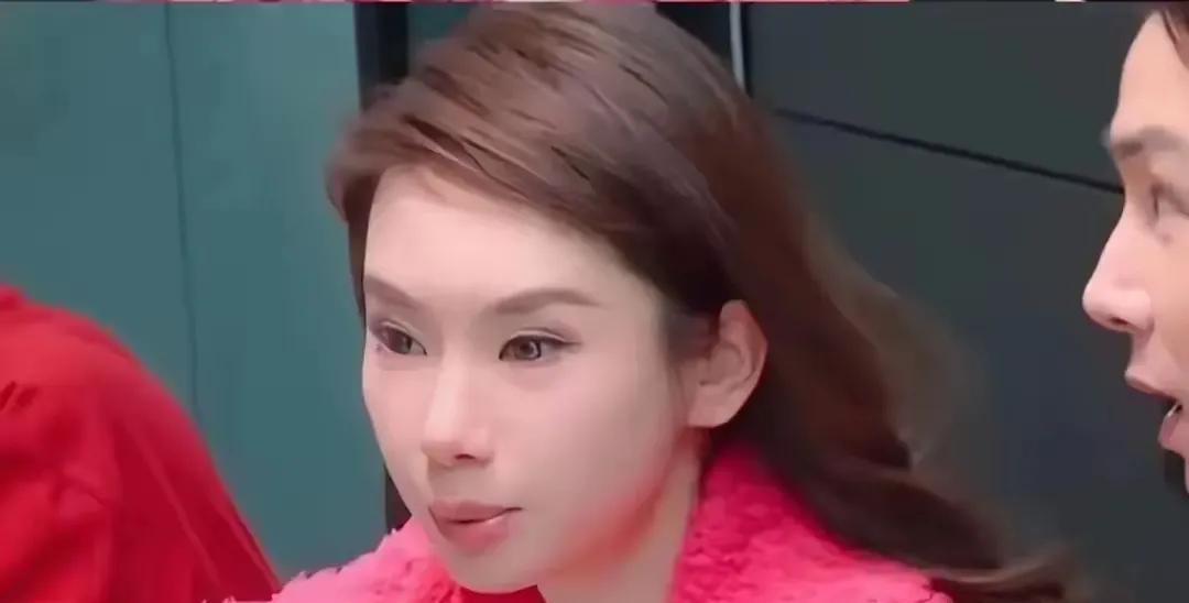 这是戚薇？怎么变成这个样子了，女星医美没有恢复能不能不要出镜啊，真的有点吓人了，