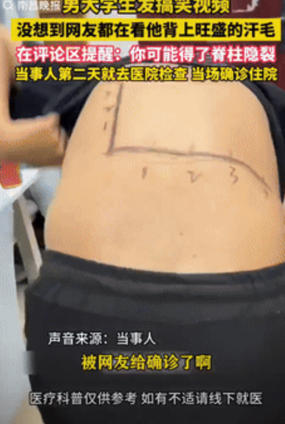 河南，一大学生闲着无聊拍搞笑视频，不料有眼尖的网友发现，小伙背上有一处汗毛非常旺