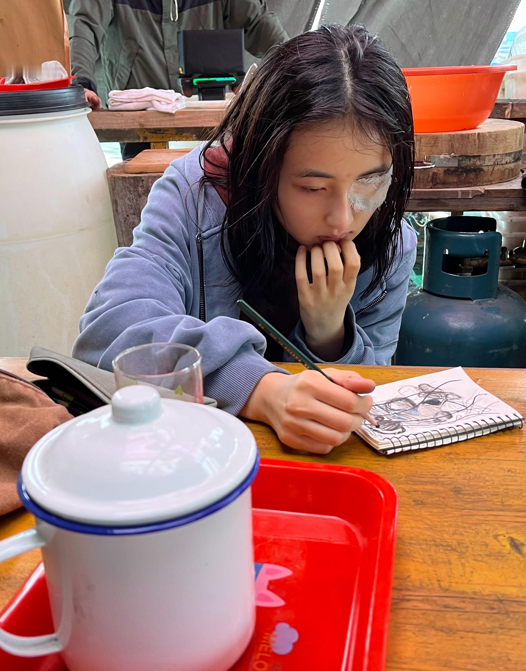 张子枫手臂上好大一个疤张子枫在复制粘贴的时代，你是手写的诗