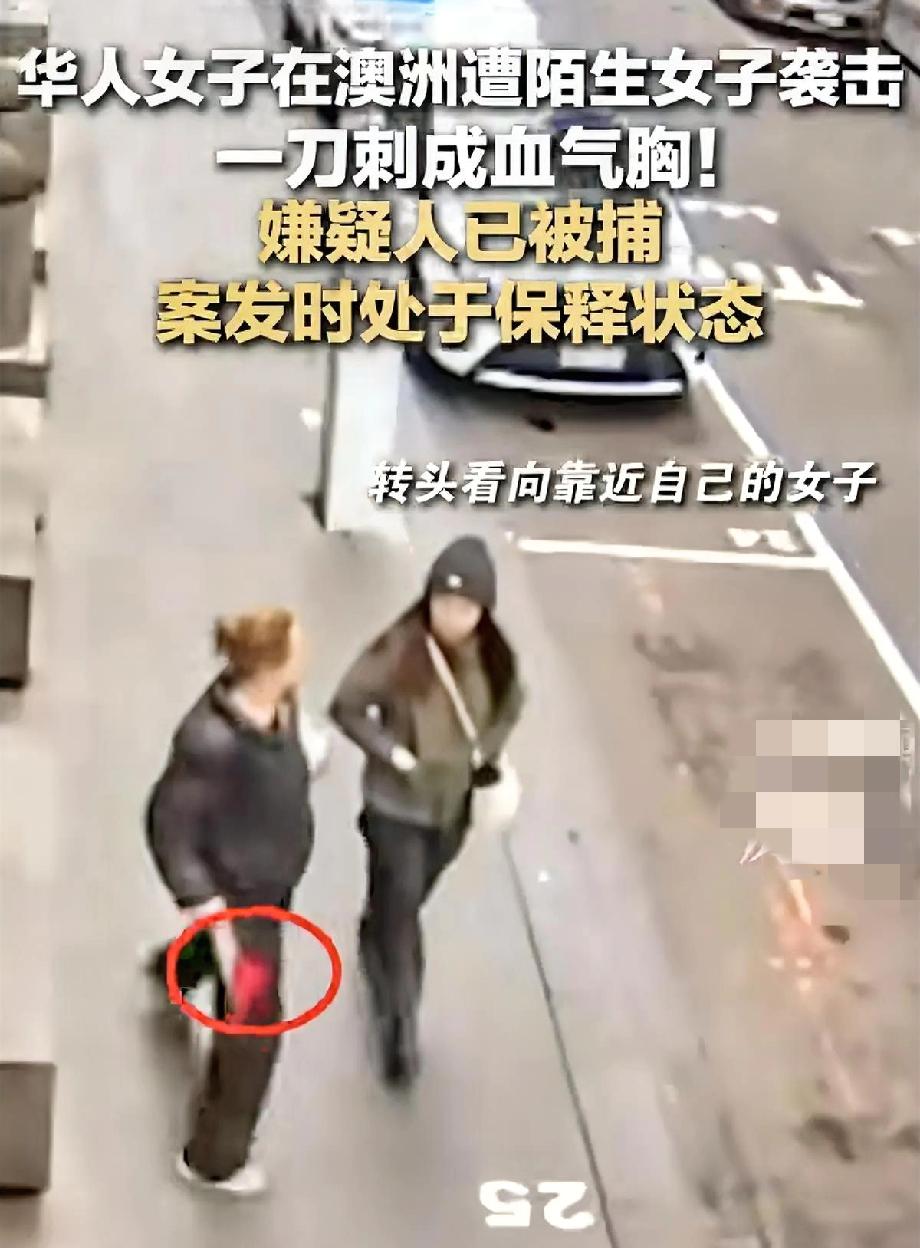 这句话出国的朋友真的得记住啊！在背后听见跑向你的声音，就应该开始准备防御了，不