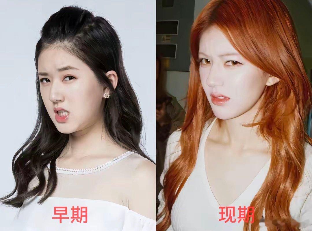 赵露思和早期的区别就是脸瘦了