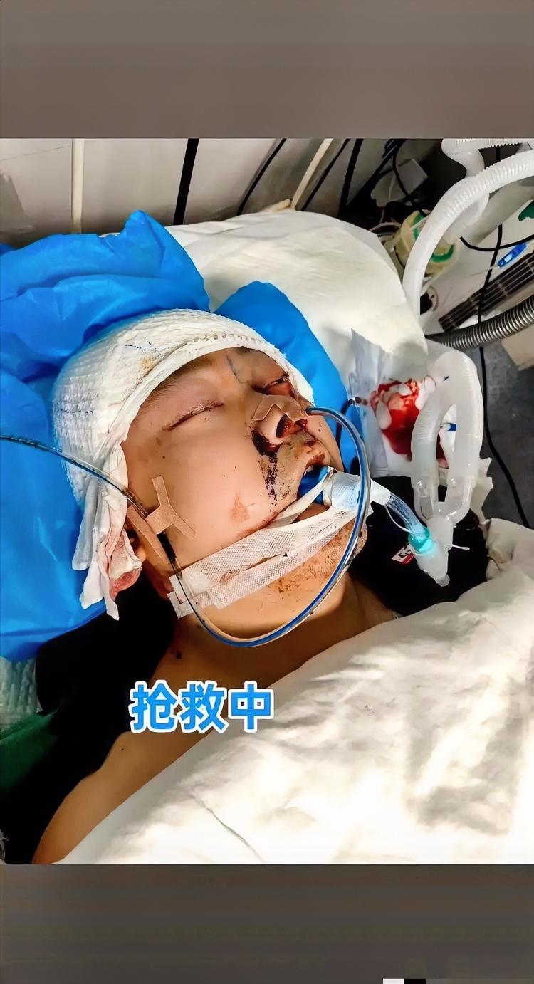 刷到安徽亳州这事儿,后背直冒冷汗。一个18岁的小伙子,凌晨一点刚下班往家走,就被