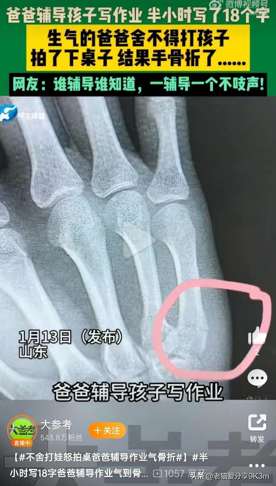 1月13日，山东一位爸爸辅导作业直接“原地爆炸”！半小时孩子只写了18个字，