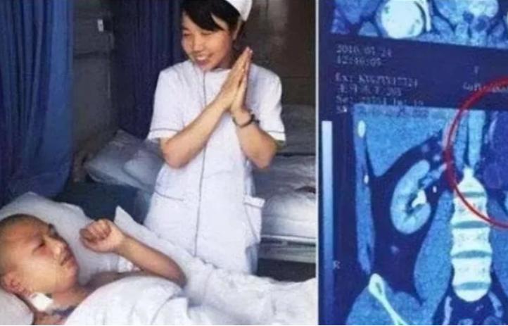 2016年，贵州妻子面对镜头，不好意思地说：“我丈夫有4个肾。”他叫王开炼，白酒