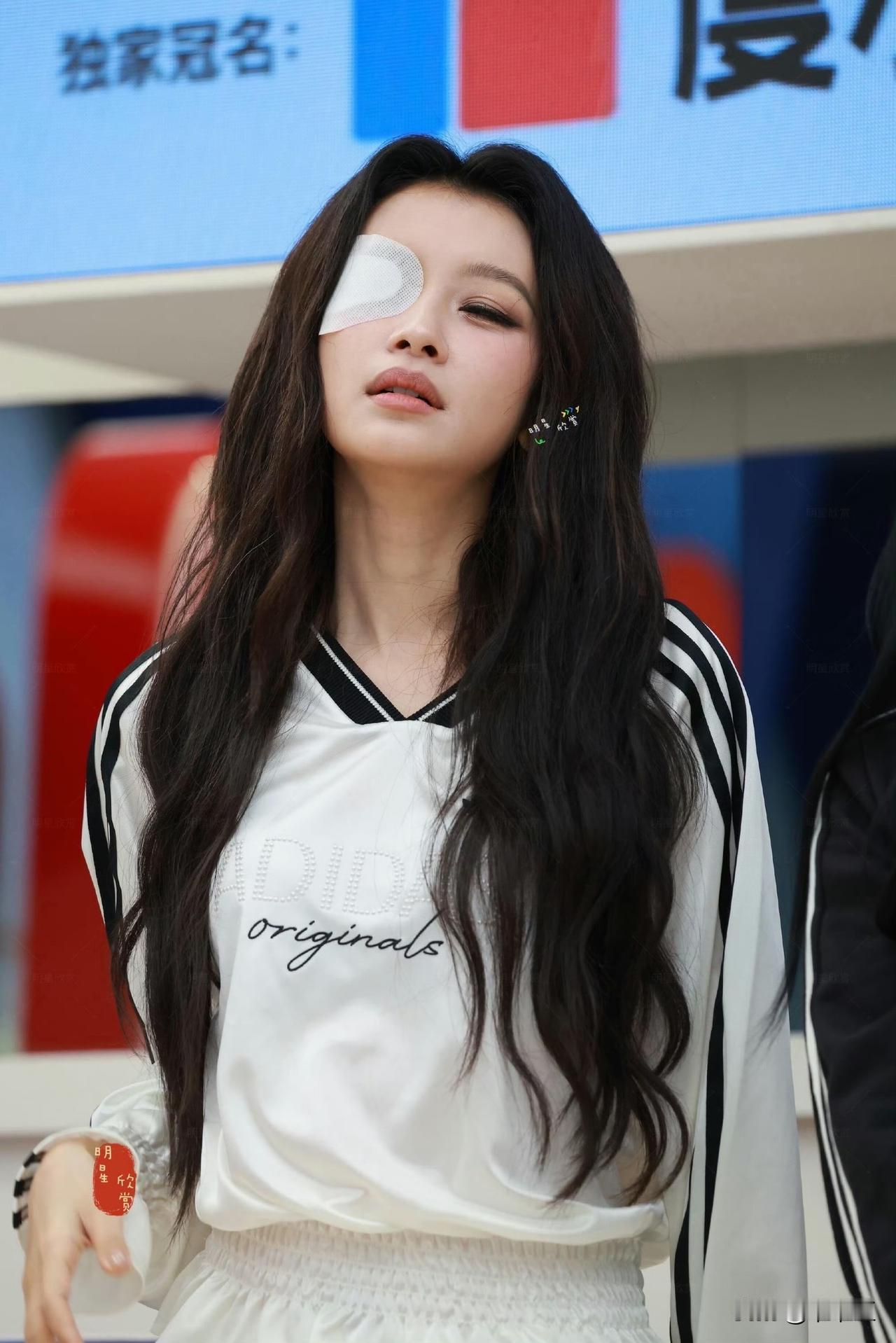 孙怡戴着眼罩发布会放话：再也不当队长！眼睛被气肿了。一公舞台刚结束，孙怡就