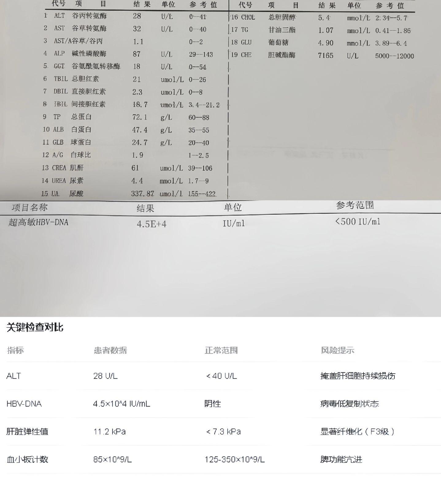 45岁张先生，乙肝携带者10年，每年单位体检转氨酶均正常，自认为